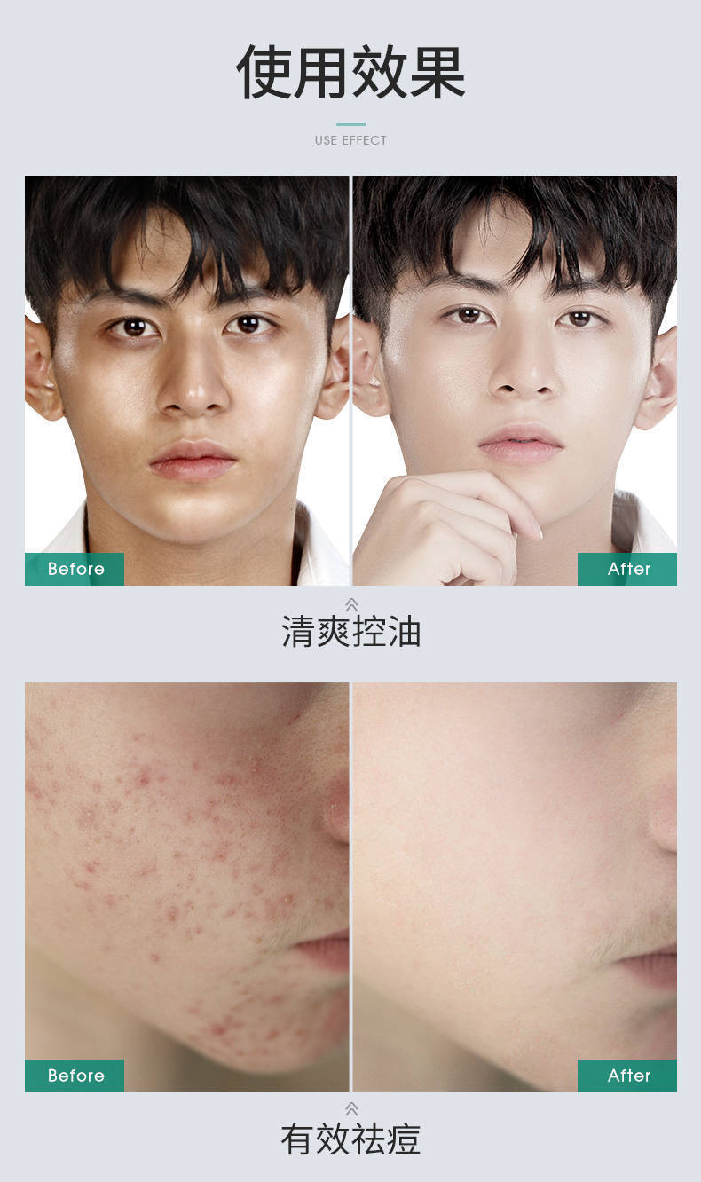 祛痘洗黑头，到底先做哪个？我的实战经验全在这了